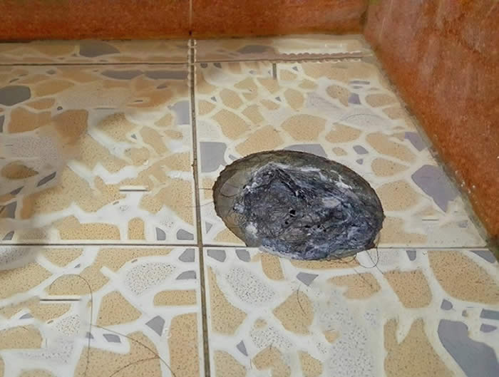 Nguyen nhan thoat san bi tac